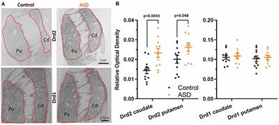 Increased Dopamine Type 2 Gene Expression in the Dorsal Striatum in Individuals With Autism Spectrum Disorder Suggests Alterations in Indirect Pathway Signaling and Circuitry